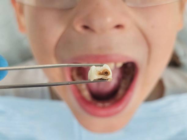 Best Cracked Tooth Emergency Dentist  in St Clairsville, OH
